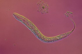 dog hookworm, ancylostoma caninum, larva